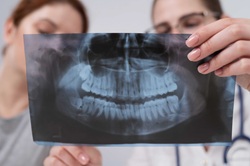 OPG Radiograph